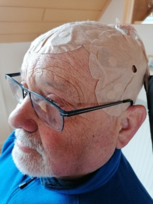 Das Foto zeigt die Elektroden am Kopf von Jürgen Schmidt.